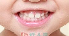 婴儿护牙小窍门